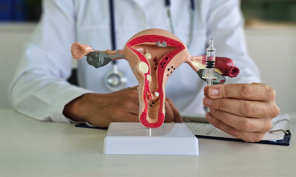 How Early Diagnosis Can Improve PCOD Treatment Success in Bangalore