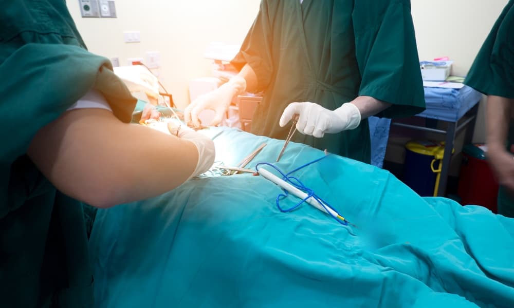 Laparoscopic Surgery for Endometriosis: What to Expect